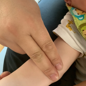 Pediatric tuina